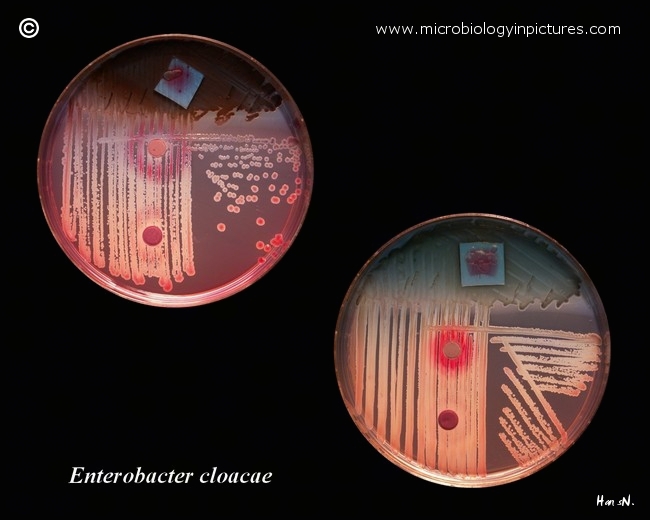 Enterobacter cloacae on Endo agar with biochemical slope preliminary identification of Enterobacter cloacae